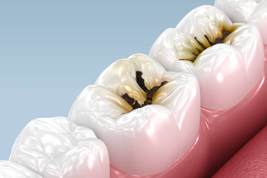 10 Daily Habits That Help Prevent Cavities and Gum Disease