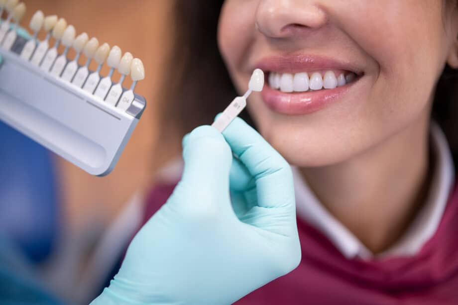 Veneers, Bonding, or Whitening: Which Cosmetic Treatment Fits Your Goals?